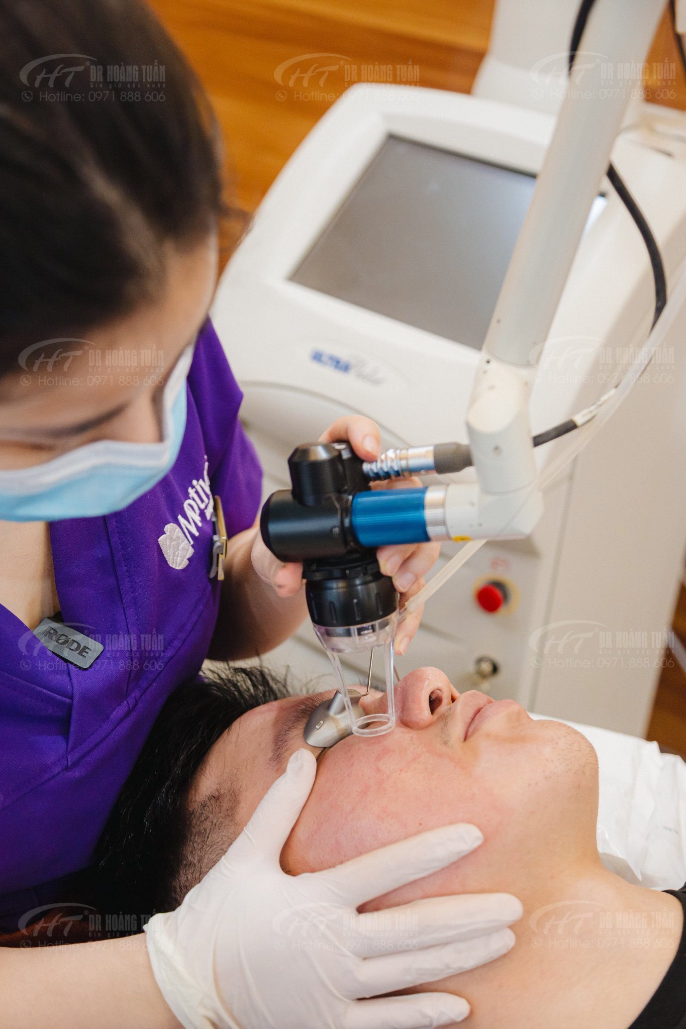 trị sẹo rỗ bằng laser trị sẹo rỗ bằng laser